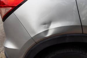 dent removal